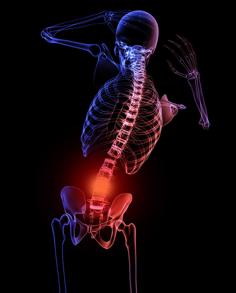 Using CBD Oil for Pain Management Explained 1 cbd oil for pain
